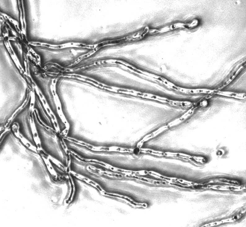 Candida albicans